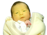 新生嬰兒黃疸