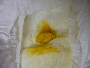 呈固體狀，似黏土